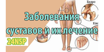 Заболевания суставов и их лечение продукцией NSP