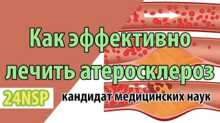 Атеросклероз сосудов и мифы о холестерине: истинные причины заболевания