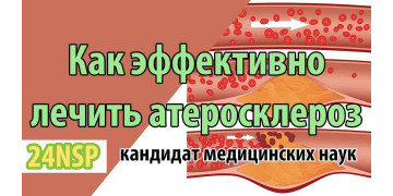 Атеросклероз сосудов и мифы о холестерине: истинные причины заболевания